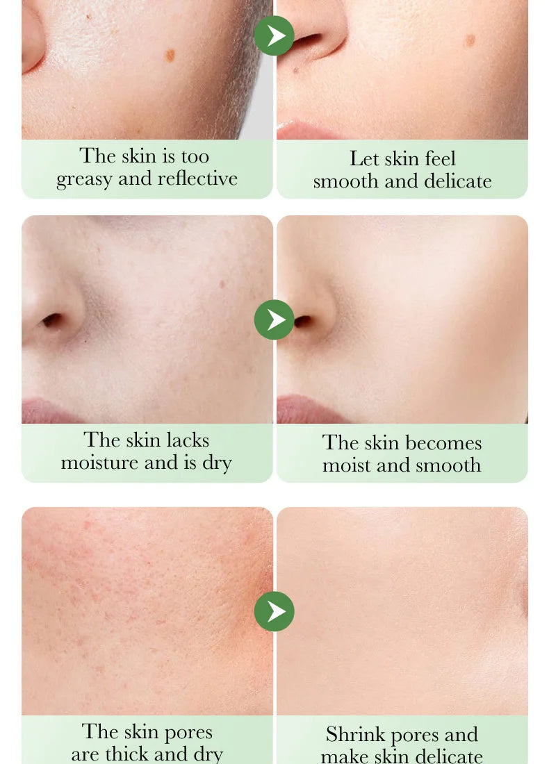 6pcs/set BIOAQUA Centella Skin Care Sets Moisturizing Anti-Aging Face Facial Cleanser Face Cream Serum Eye Cream Skin Care Kit