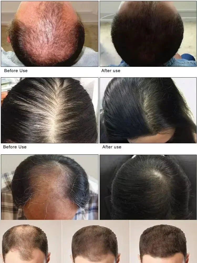 Batana Oil Hair Growth Serum Spray Repair Hair Nourish Root Regrowth Hair Anti Hair Loss Essence Men Women Hair Care Products