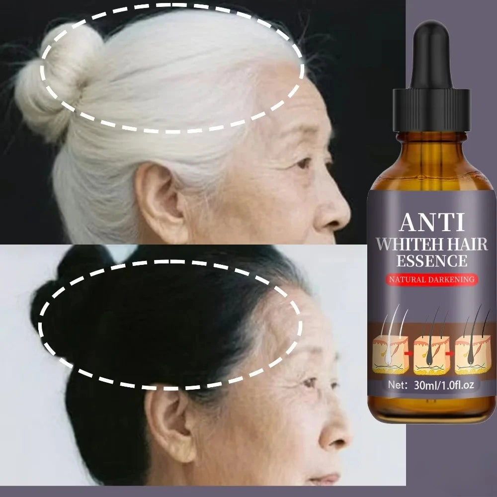 Nourish Hair Roots Scalp Care Support Hair Density Boost Skin Elasticity For Thicker Healthier-Looking Hair Daily Use.