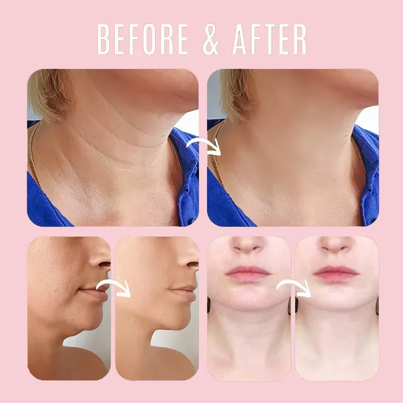 Eelhoe Collagen & Hyaluronic Acid Multi Bounce Balm Stick 9g – Instant Anti-Aging, Wrinkle Reduction, Brightening & Moisturizing | CPNP Certified