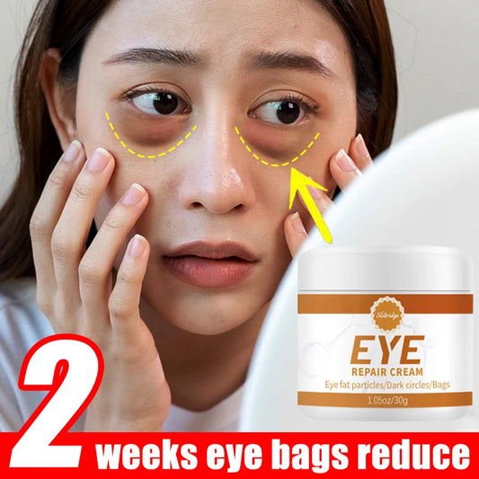 Eye Cream for Dark Circles & Puffy Eyes — Daily Hydration
