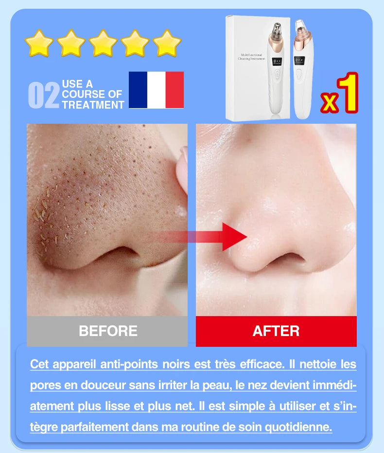 Blackhead Remover Pore Cleaner Black Dots Vacuum Cleaner Skin Pimple Acne Extractor Facial Cleaning Electric Black Head Removal.