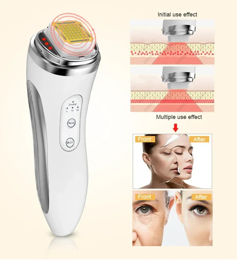 RF Radio Frequency Face Lifting Device Dot Matrix Beauty Massager Home Wrinkle Remover Skin Tightening Facial Massage Machine, women