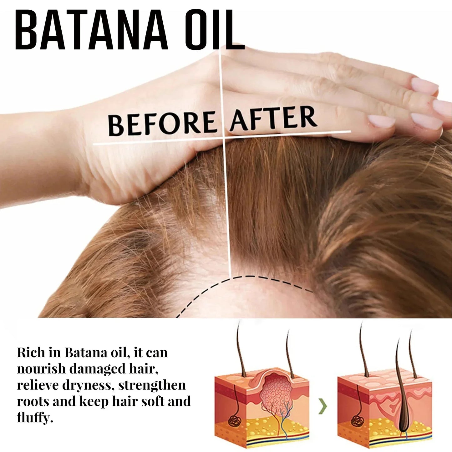 7 Days Fast Batana Oil Hair Growth Serum Anti-loss Hair Regrowth Products Repair Damaged Hair Roots Hair Care For Women Men