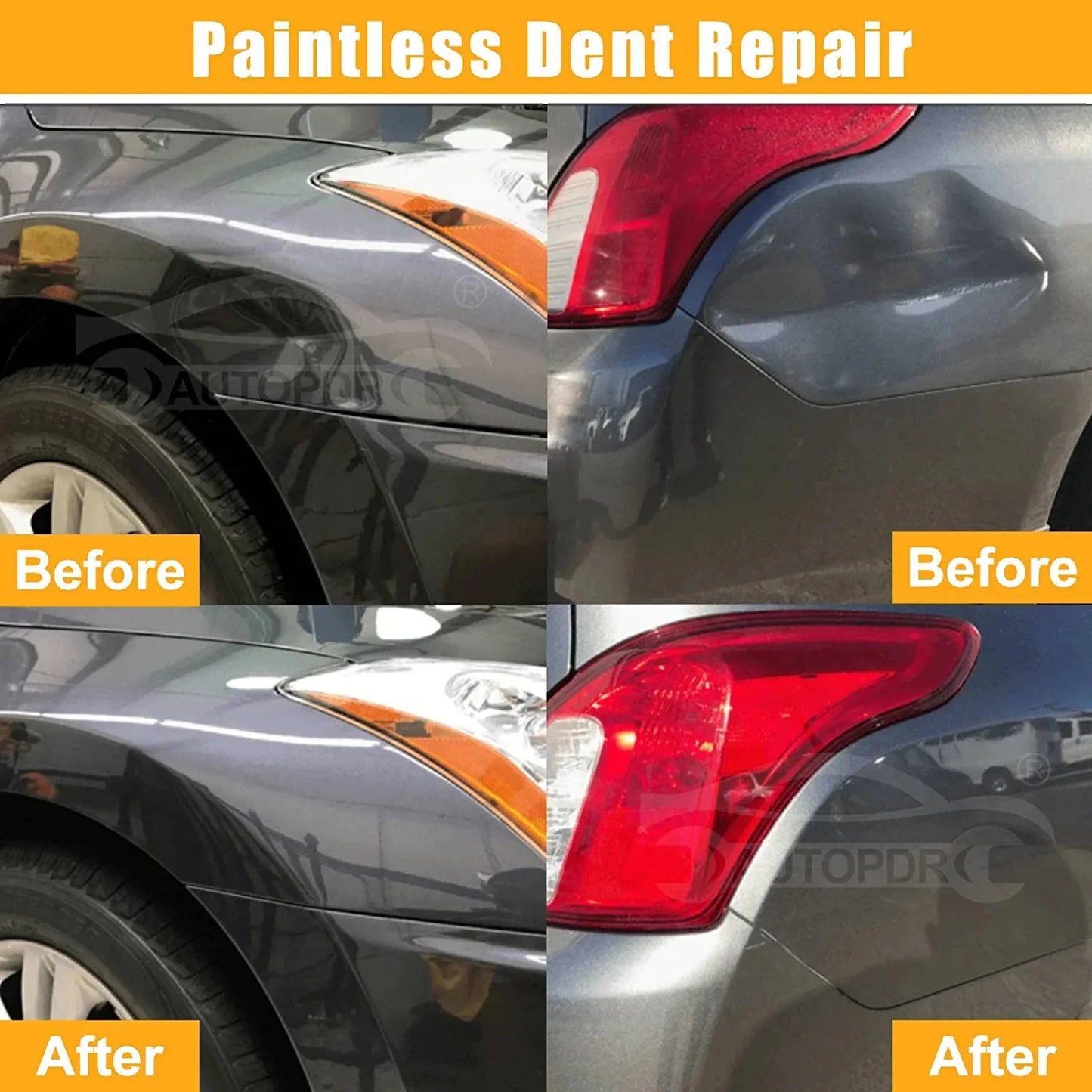PDR Auto Paintless Body Dent Removal Kits Car Dent Repair Tools Automotive Dent Remover Suction Cup Dent Puller Tool Kit for Car