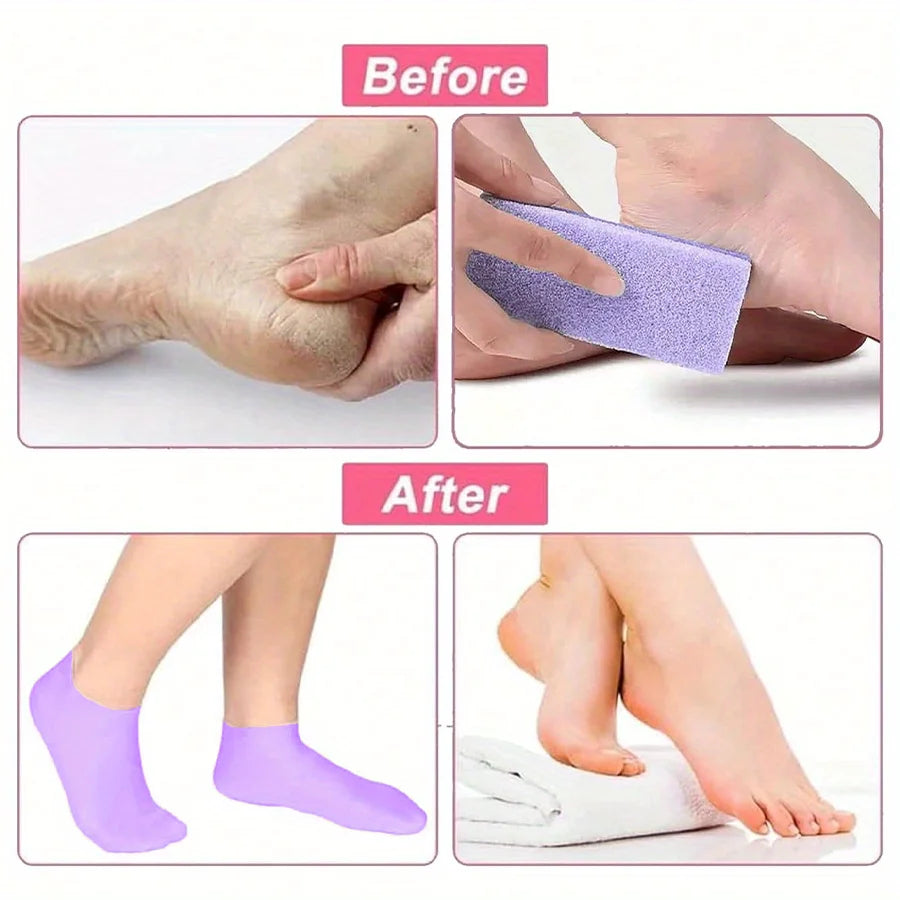 Moisturizing silicone foot socks for dry heels — view 5 of 17
