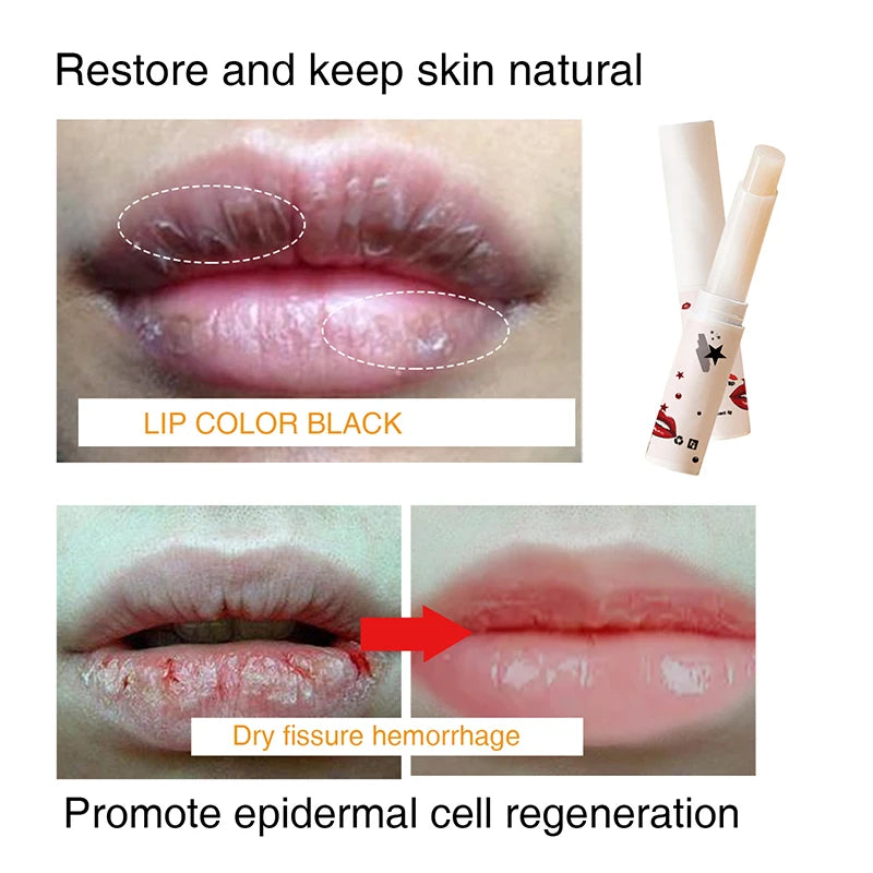 Lip Balm Remove Dark Lips Eliminate Dark Marks - Smooth Lip Lines Prevent Dryness Remove Black Pigment Lip Care Treatment