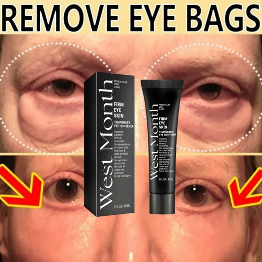 Lifting Eye Cream — Tightening Care for Eye Bags