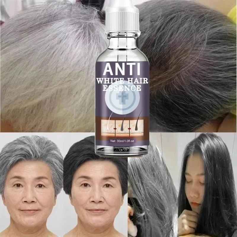 White hair killer, remove gray hair and restore natural hair color in 7 days