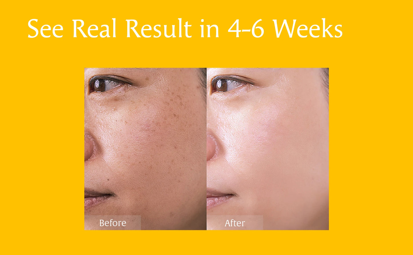 Turmeric Kojic Acid Amino Acids Foam Cleanser – Gentle Cleansing, Face & Body Brightening, for Dark Spots, Uneven Skin Tone