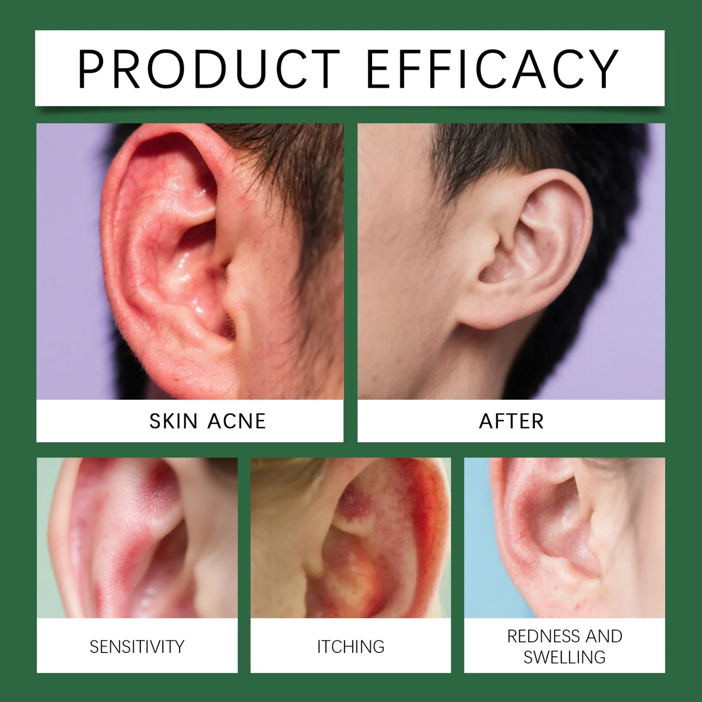 Herbal Ear Cleansing Drops — Gentle Earwax Softening & Ear Care
