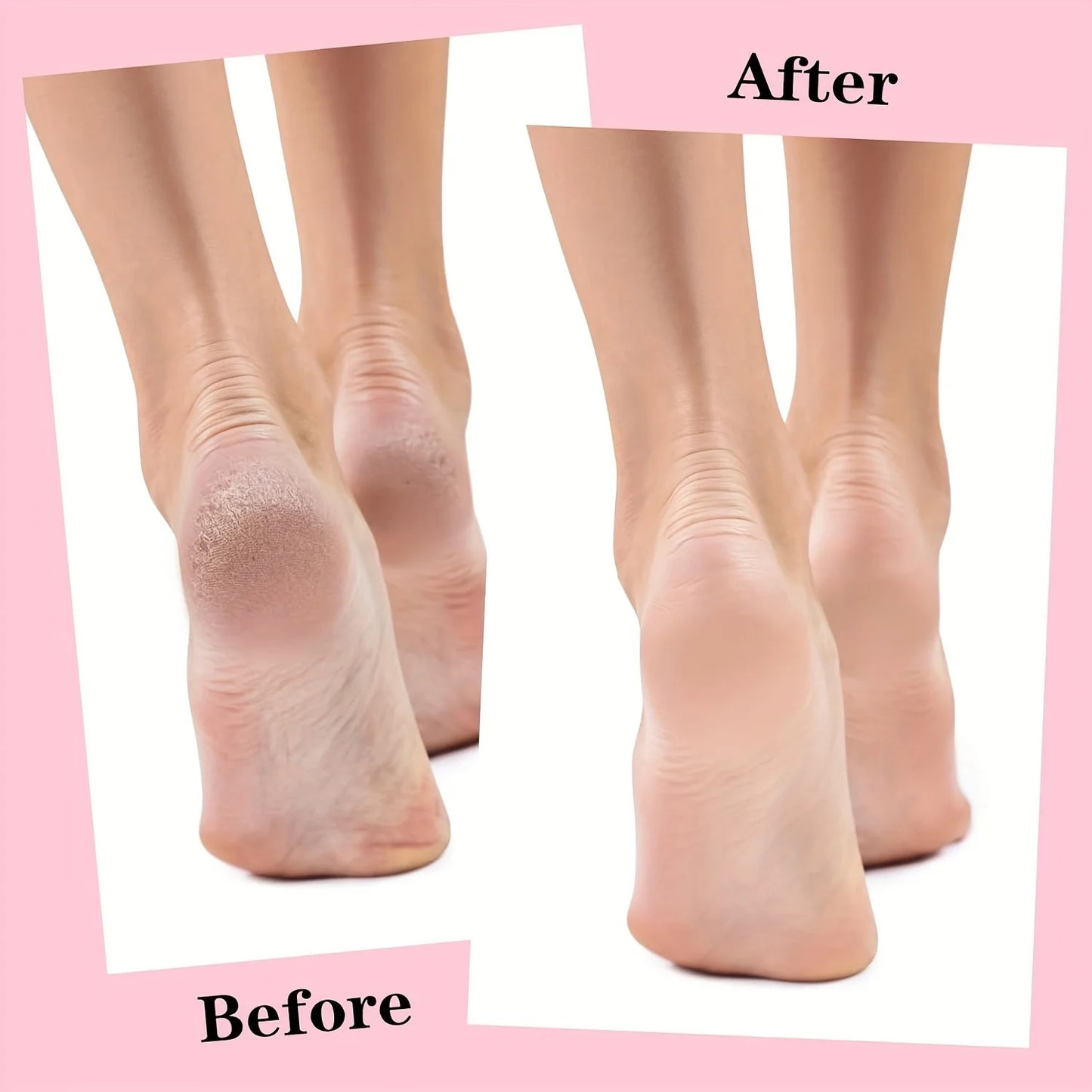 1 Pair Silicone Gel Moisturizing Foot Socks for Dry, Cracked Feet - Soothing Massage Pedicure Care Tool