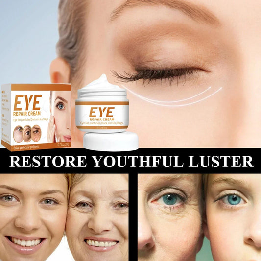 Under-Eye Cream — Fine Lines, Dark Circles & Puffiness
