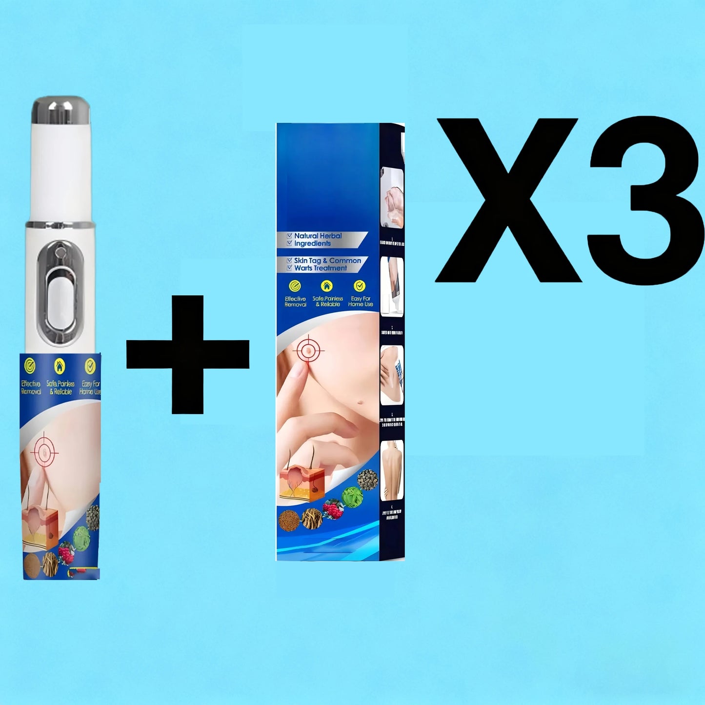 2026 New Upgrade Blue Laser Solve Wart Tool