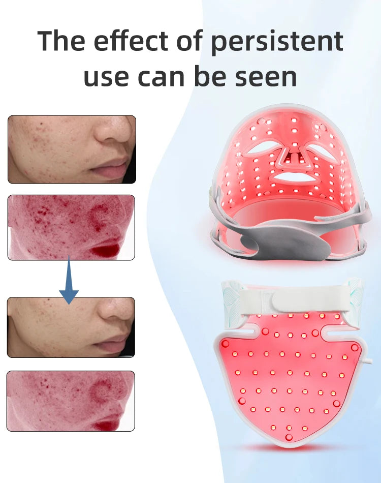 7 Colors + Infrared LED Face & Neck Mask – Red Light Therapy for Anti-Aging, Acne & Skin Tightening