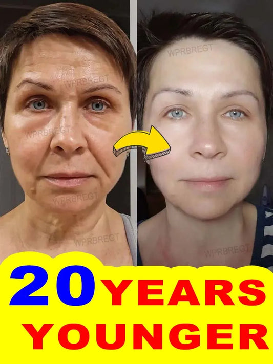 Anti-Aging Instant Wrinkle Smoothing Cream – Look 20 Years Younger | Fine Lines & Firming Face Treatment