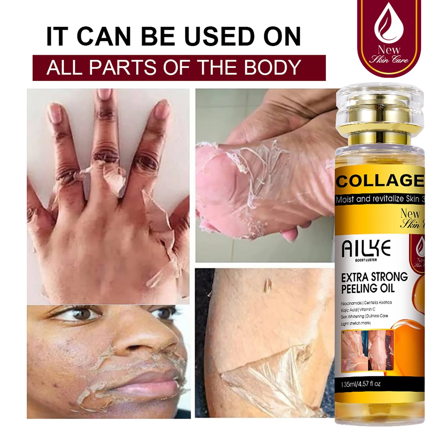 AILKE Collagen & Kojic Acid Peeling Oil 135ml – Whitening, Exfoliating & Brightening for Face, Body, Hands & Feet | All Skin Types