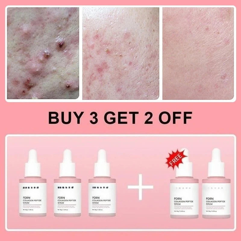 Salmon PDRN Collagen Peptide Facial Serum for Dull Skin - Boosts Elasticity Skin Renewal Repair Korean Beauty Product