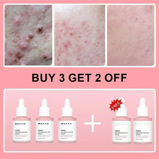 Salmon PDRN Collagen Peptide Facial Serum for Dull Skin