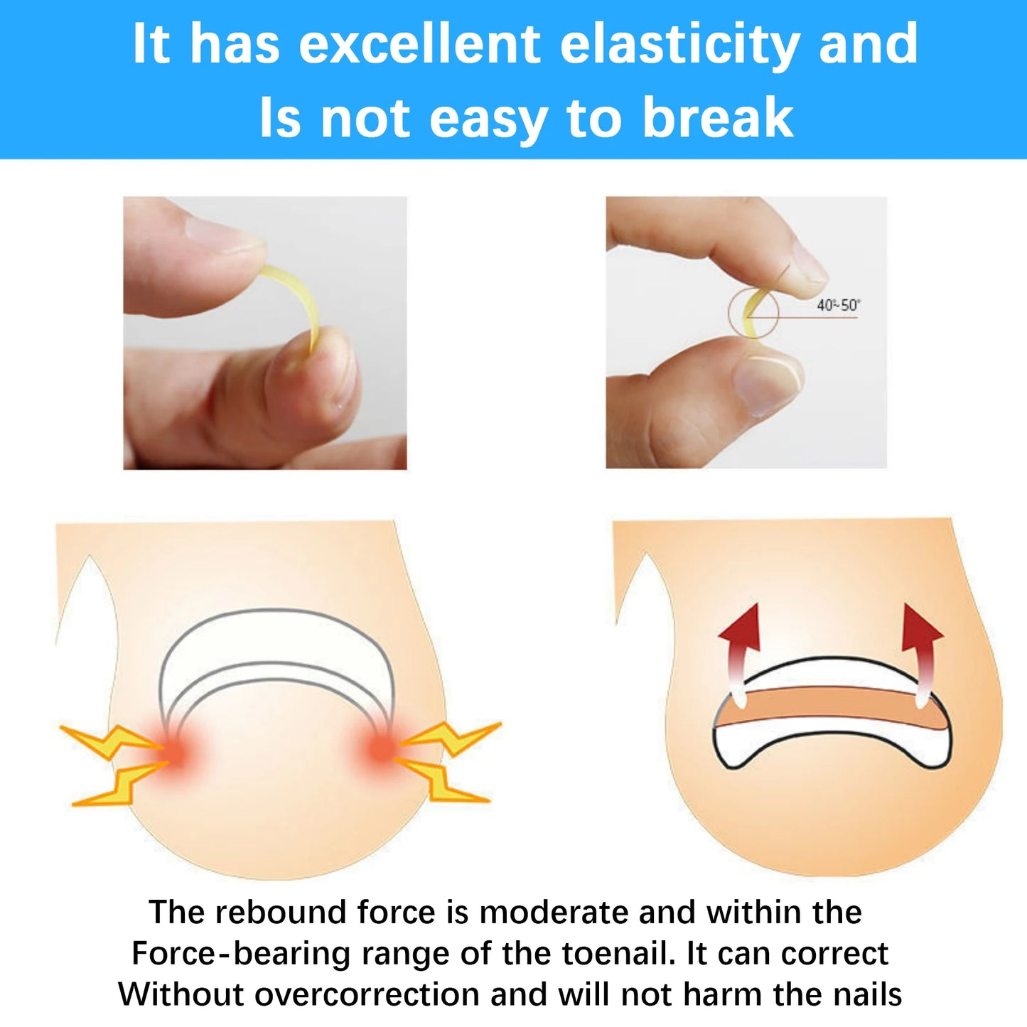 50Pcs Ingrown Toenail Correction Tool Ingrown Toe Nail Treatment Elastic Patch Sticker Straightening Clip Brace Pedicure Tool