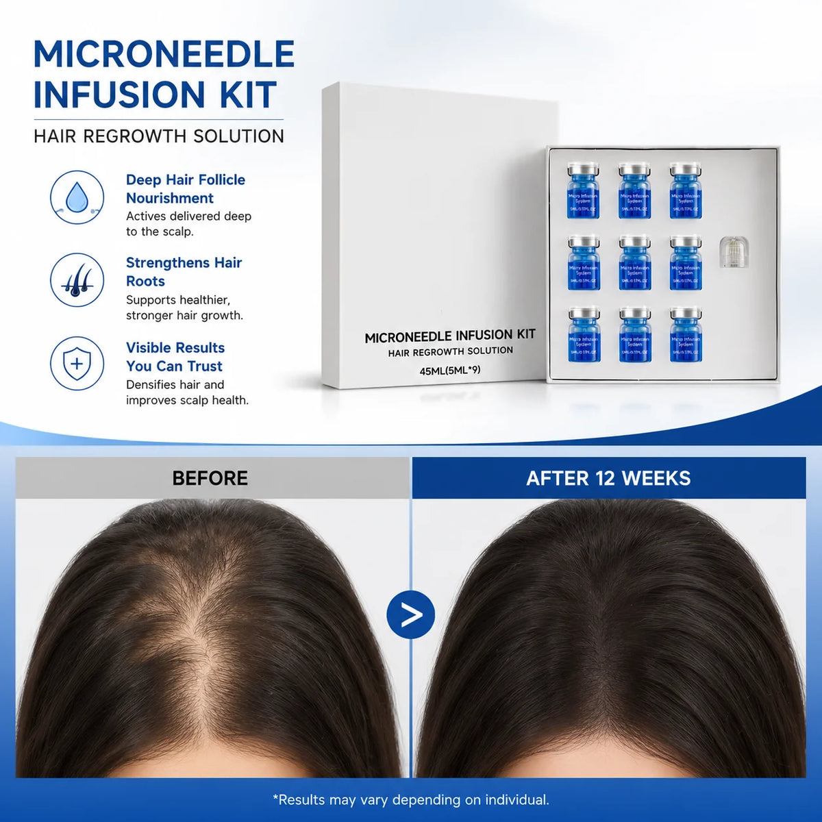 Scalp Care Kit with Derma Roller & Nourishing Serum