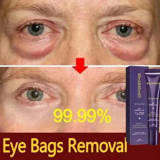 Retinol Eye Gel – Dark Circles, Eye Bags & Wrinkle Treatment