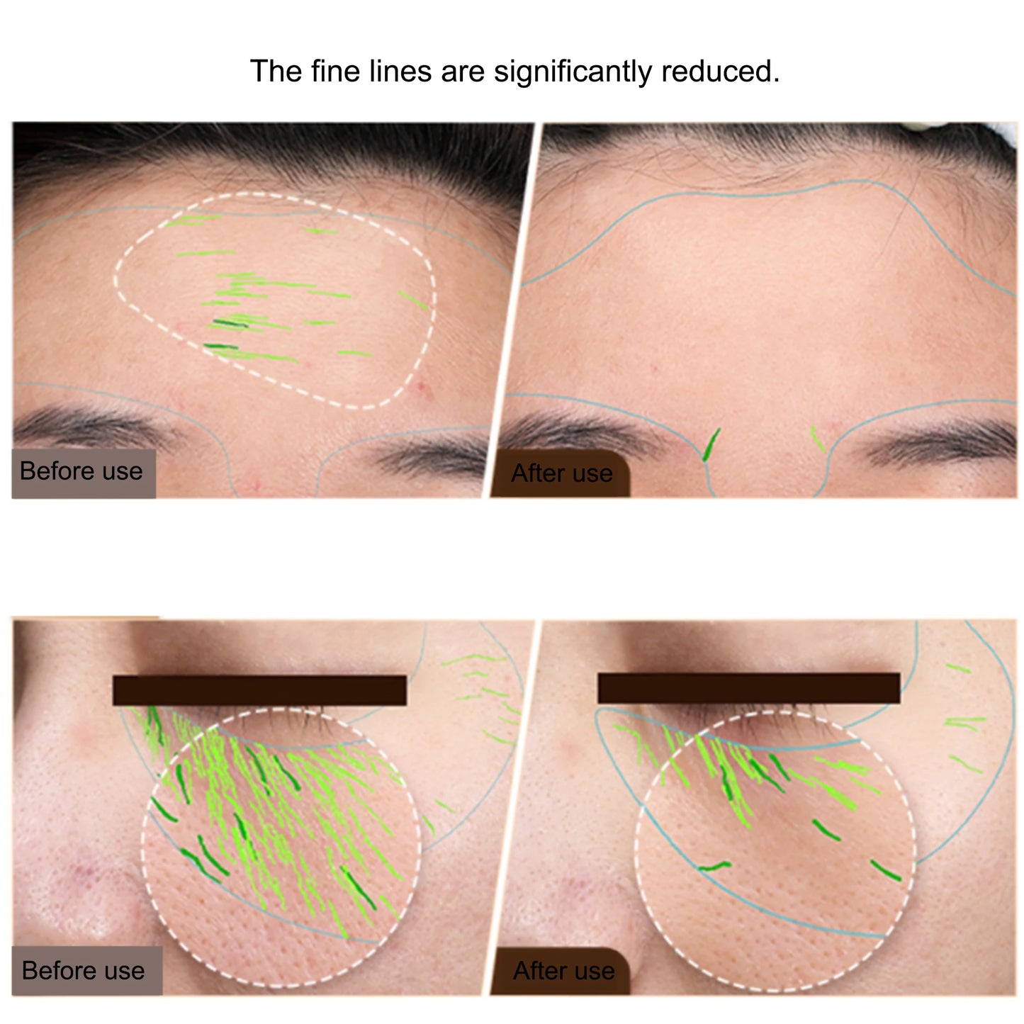 EMS Facial Body Radio Frequency Machine Skin Tightening Face Lifting RF Beauty Device Professional Home RF Skin Care Anti Aging, women