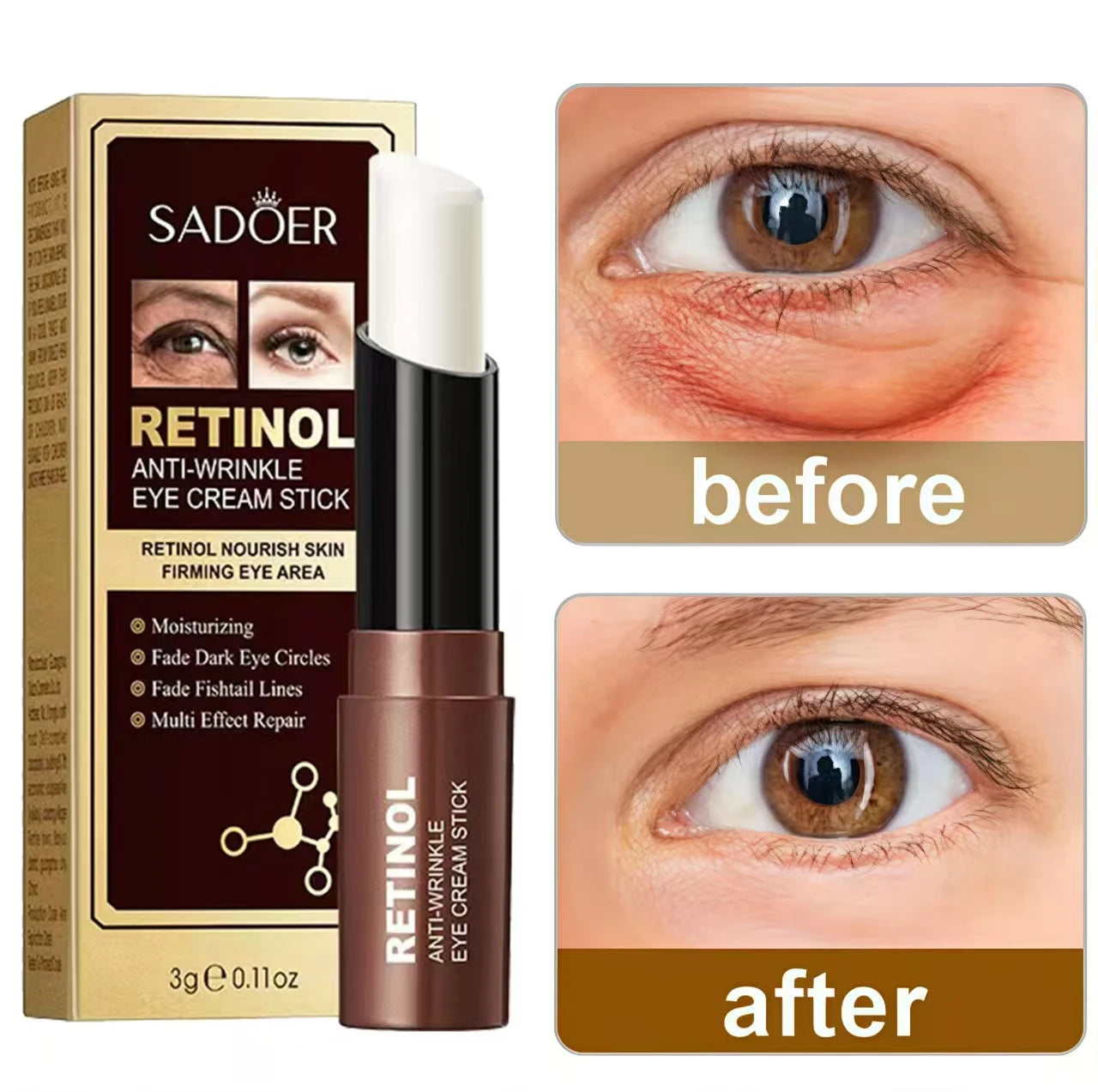 Eye Cream Removing Dark Circles Wrinkle  Lightening Fine Lines Moisturizing Whitening Skin Care Remove Eye Bag Sti
