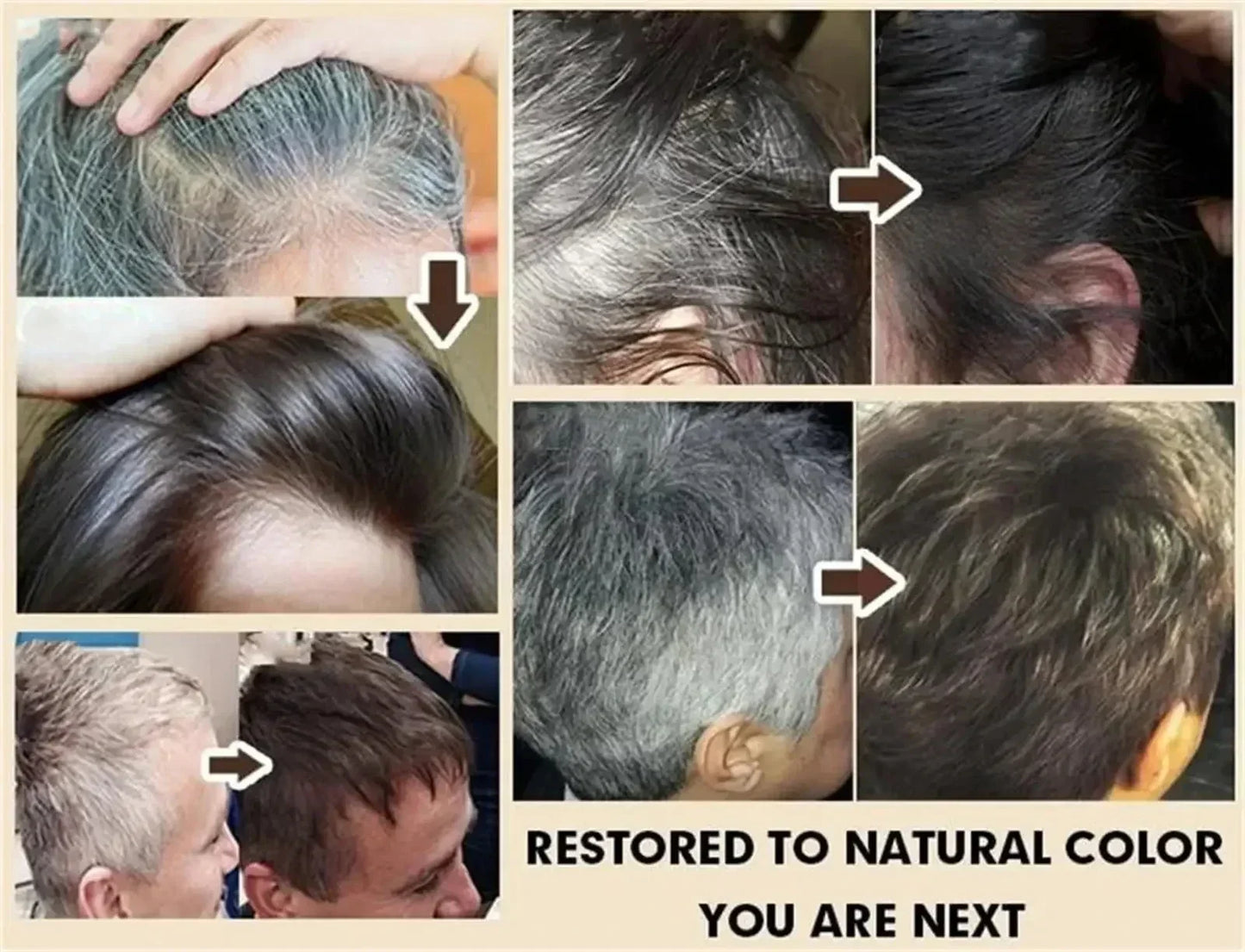 Nourish Hair Roots Scalp Care Support Hair Density Boost Skin Elasticity For Thicker Healthier-Looking Hair Daily Use.