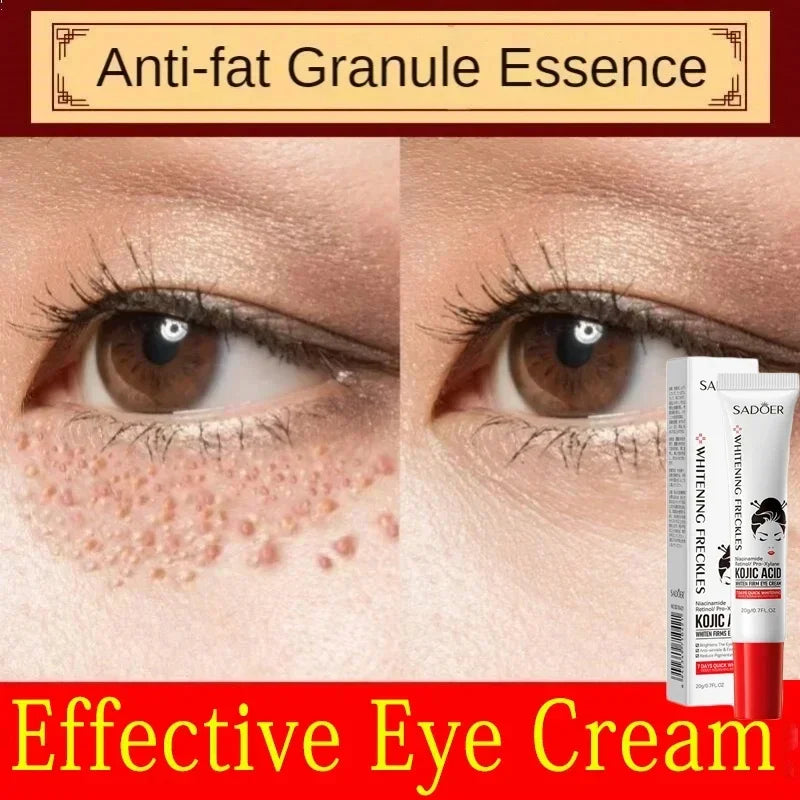 Fat Granules Remover Eye Cream Anti-Puffiness Anti Inflammatory Reduce Dark Circles Eyebags Fade Lines Moisturizing Eye Care New