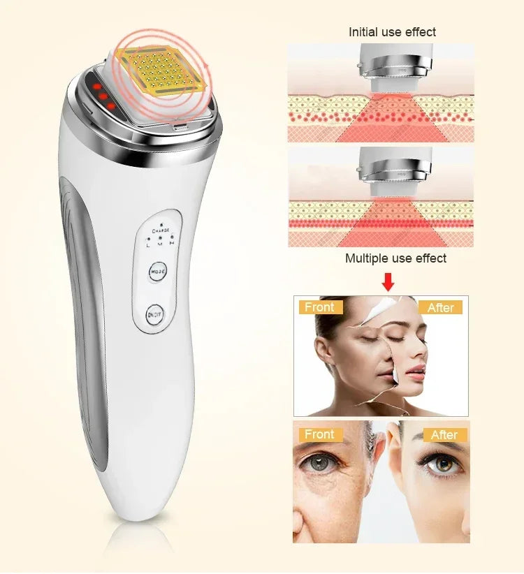 RF Radio Frequency Face Lifting Device Dot Matrix Beauty Massager Home Wrinkle Remover Skin Tightening Facial Massage Machine, women