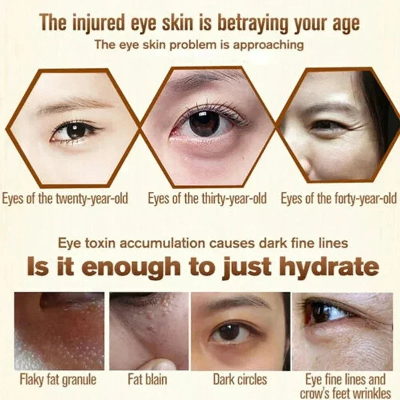 Fat Granules Remover Eye Cream Anti-Puffiness Anti Inflammatory Reduce Dark Circles Eyebags Fade Lines Moisturizing Eye Care New