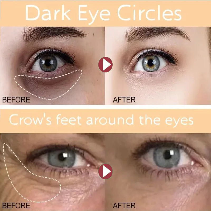 7 Day Tighten Wrinkles Eye Cream Remove Eye Fat Bags Puffiness Lifting Firming Smooth Eye Massage Cream Nourish Eye Skin Care