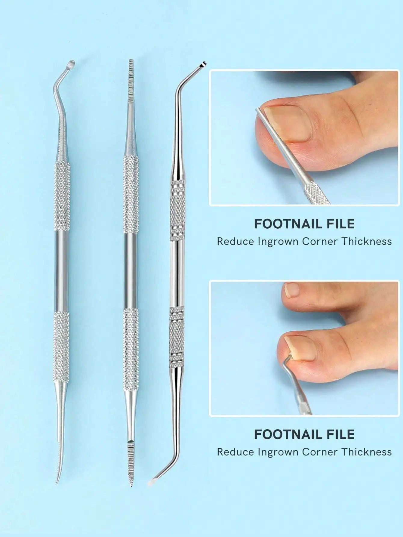 3pcs Nail Stain Removal Tool, Multifunctional Nail File, Pedicure Tool Beauty File, Ingrown Toenail Tool Pedicure Nail Cleaner