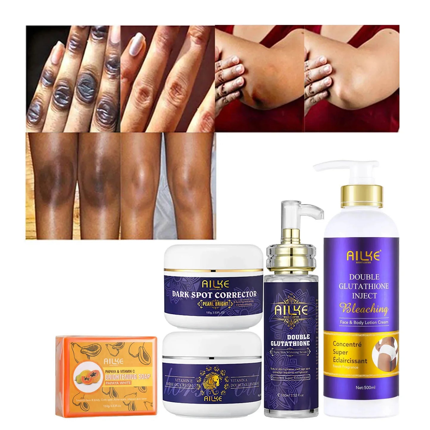 AILKE Glutathione 5-in-1 Women Skin Care Kit, With Body Lotion,  Serum, Dark Spot Removal Cream, Body Cream, Brightening Soap