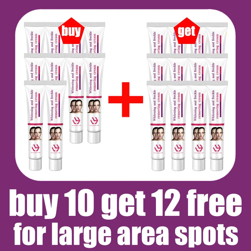Facial Lightening for Freckles, Melasma & Dark Spots