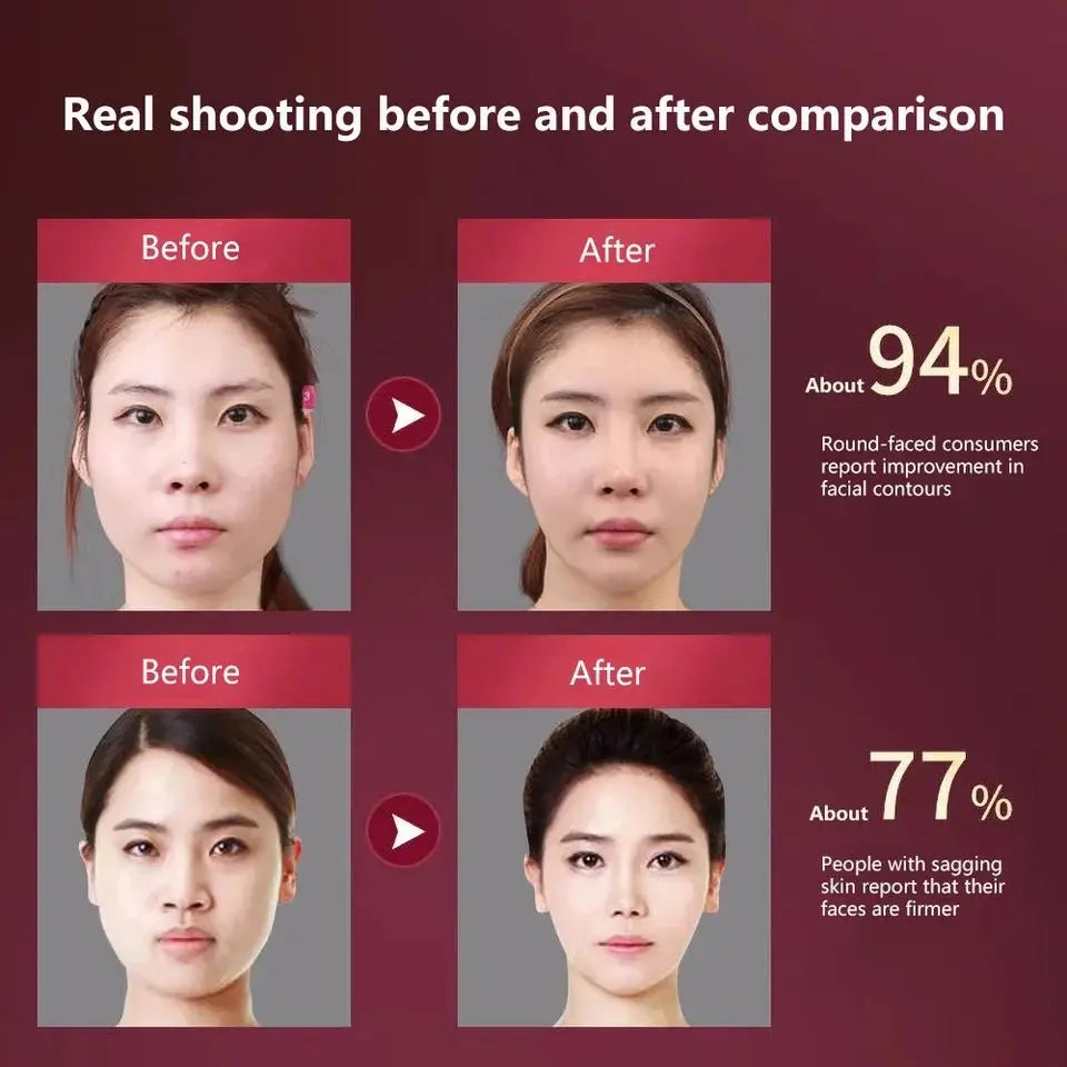 LED Photon Facial Massager — Heated Vibration Lifting Device