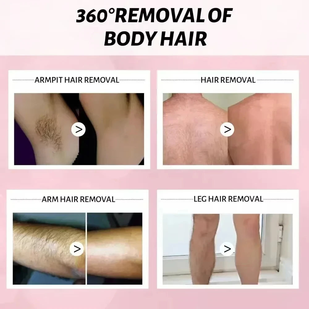 Soothing Body Cream for Post-Hair Removal - Allantoin & Lupine