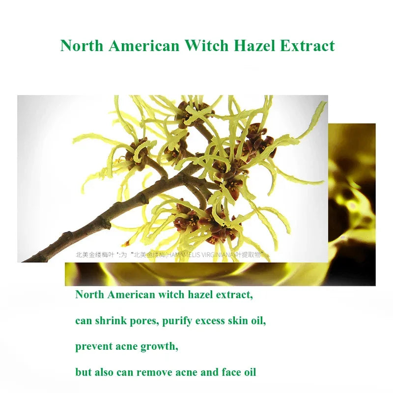 Herbal Acne & Blackhead Cream – Oil-Control, Pore-Refining Gel for Blemish-Prone Skin
