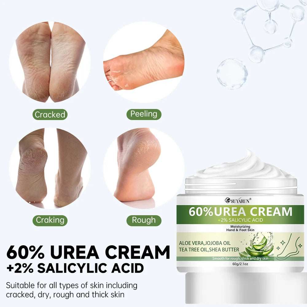 SUYARUN 60% Urea+2% Salicylic Acid Exfoliating Foot Cream, Aloe & Tea Tree, Soothing Moisturizing & Hydrating for Cracked Heels.
