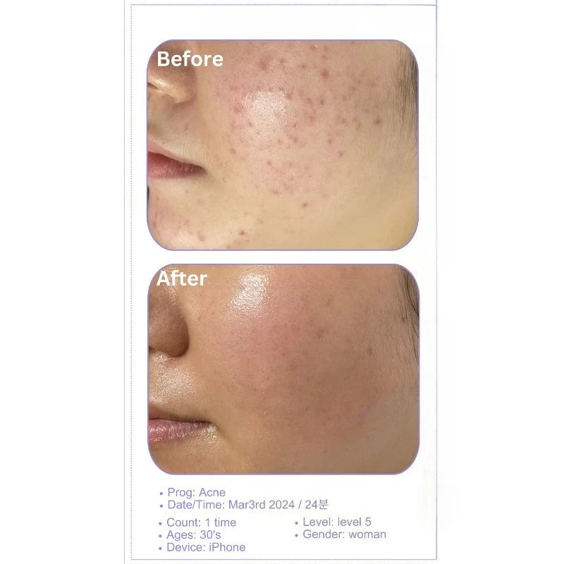Made in Korea Korean KBeauty Portable Ultrasonic Skincare Device in Lumi White for Facial Steamer Use Korea