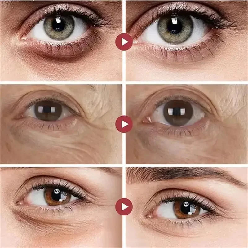 Eye Bags Cream Instant Removes Dark Circles Tightens The Eyes Lifting Firming And Removing Eye Bags Make Your Eyes More Lively