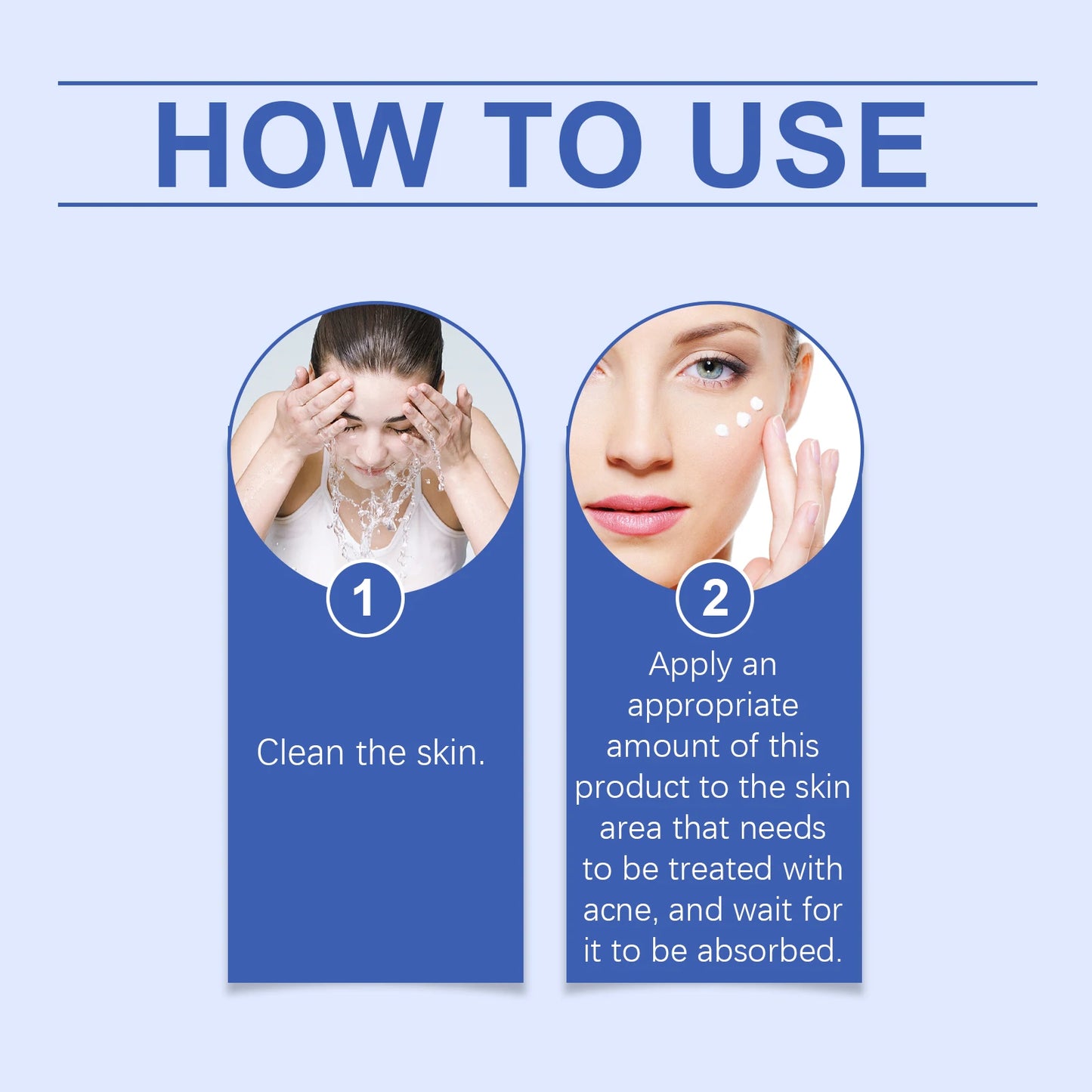 South Moon Anti Acne Cream Oil Control Repair Pimple Spot Remove Acne Mark Cleaning Refreshing Moisturize Skin Pore Shrink Cream