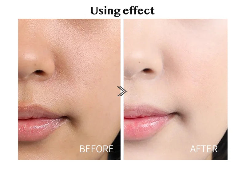 28 Bottles Skincare Revitalizer Hyaluronic Acid Ampoule Essence Moisturizer Face Toner Pores Shrinking Whitening Facial Serum