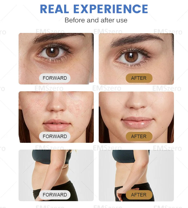Portable 2-in-1 facial privacy 7D HI * FU machine for facial lifting wrinkle removal anti-aging and skin tightening 2026