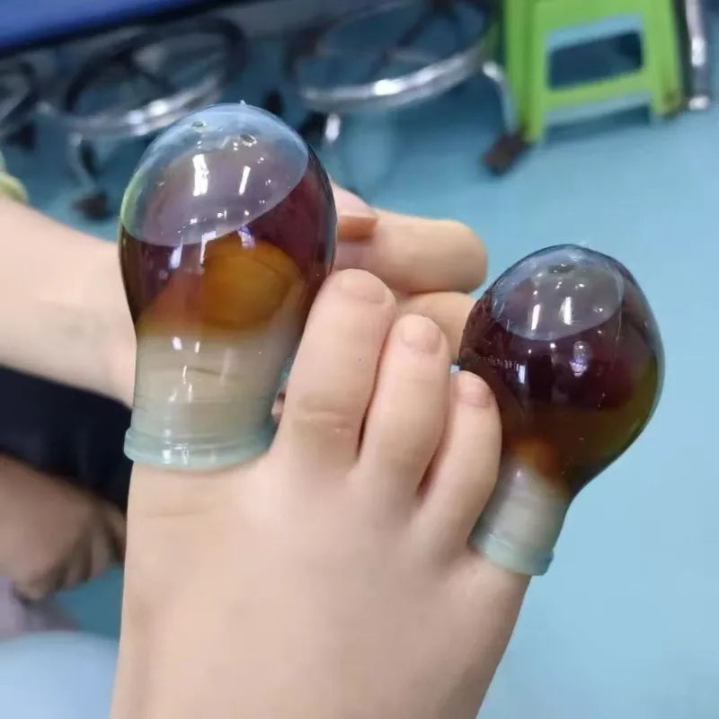 1Pcs Soft Silicone Toe Sleeves Toe Protectors, Reduce Friction Prevents Nail Insertion for Wound Care and Cutaneous Infections