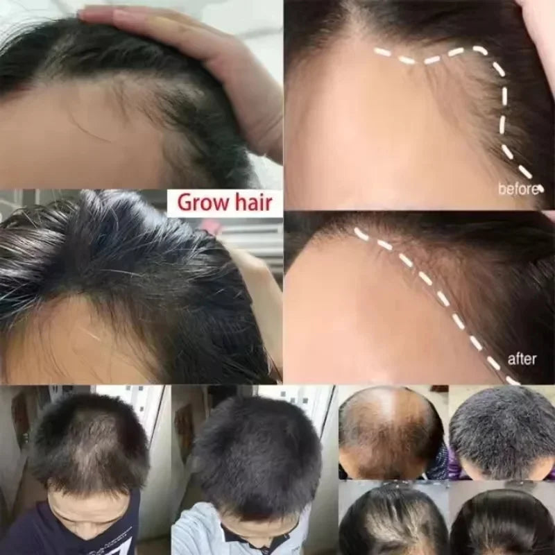 Batana Oil Hair Growth Serum Spray Repair Hair Nourish Root Regrowth Hair Anti Hair Loss Essence Men Women Hair Care Products