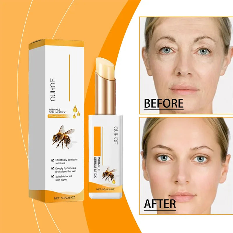 YP03 Anti wrinkle eye ointment is used for dark circles, eye bags, and puffiness