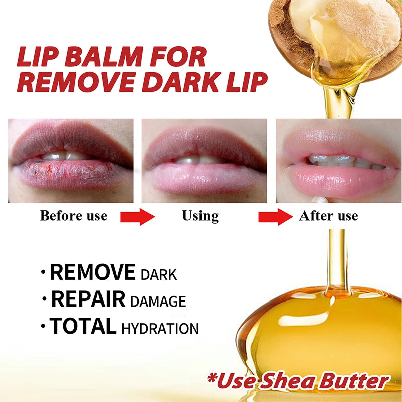 Lip Balm Remove Dark Lips Eliminate Dark Marks - Smooth Lip Lines Prevent Dryness Remove Black Pigment Lip Care Treatment