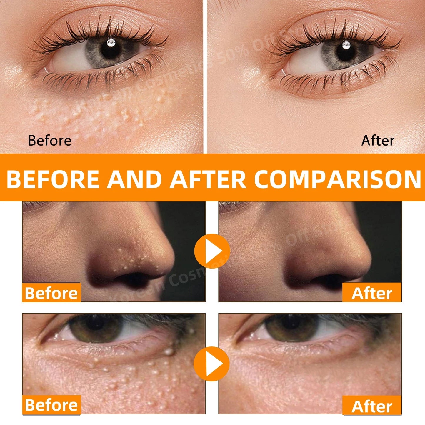 Fat Granules Removal Eye Serum Anti Dark Circle Eye Bags Fade Fine Line Essence Anti-Puffiness Moisturizing Skin Care Products